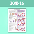 Плакат «Что такое лейкемия?» (ЗОЖ-16, ламинир. бумага, A1, 1 лист)